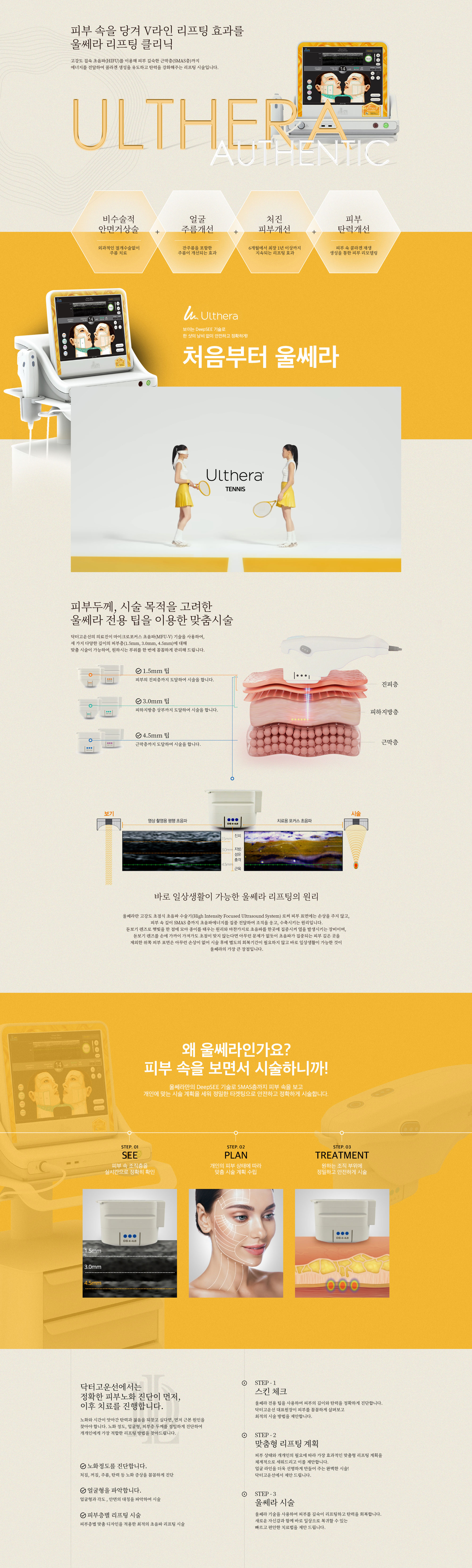 울쎄라 리프팅